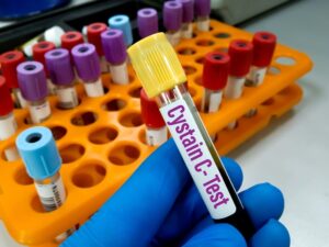 Respiratory Diseases